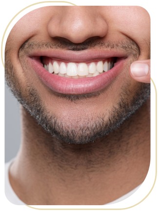 Cosmetic Bonding Near Me in Encino, CA