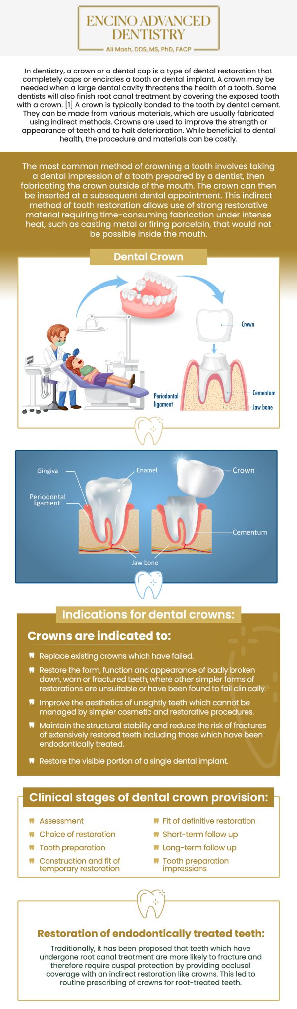 Common questions asked by patients: What is a dental crown, and when do you need one? Can a dental crown fix a cracked or broken tooth? What types of materials are used for dental crowns? How long do dental crowns last? For more information, contact us or schedule an appointment online. We are conveniently located at 5363 Balboa Blvd, #434 Encino, CA 91316. We serve patients from Encino CA, Tarzana CA, Van Nuys CA, Sherman Oaks CA, Calabasas CA, and surrounding areas.