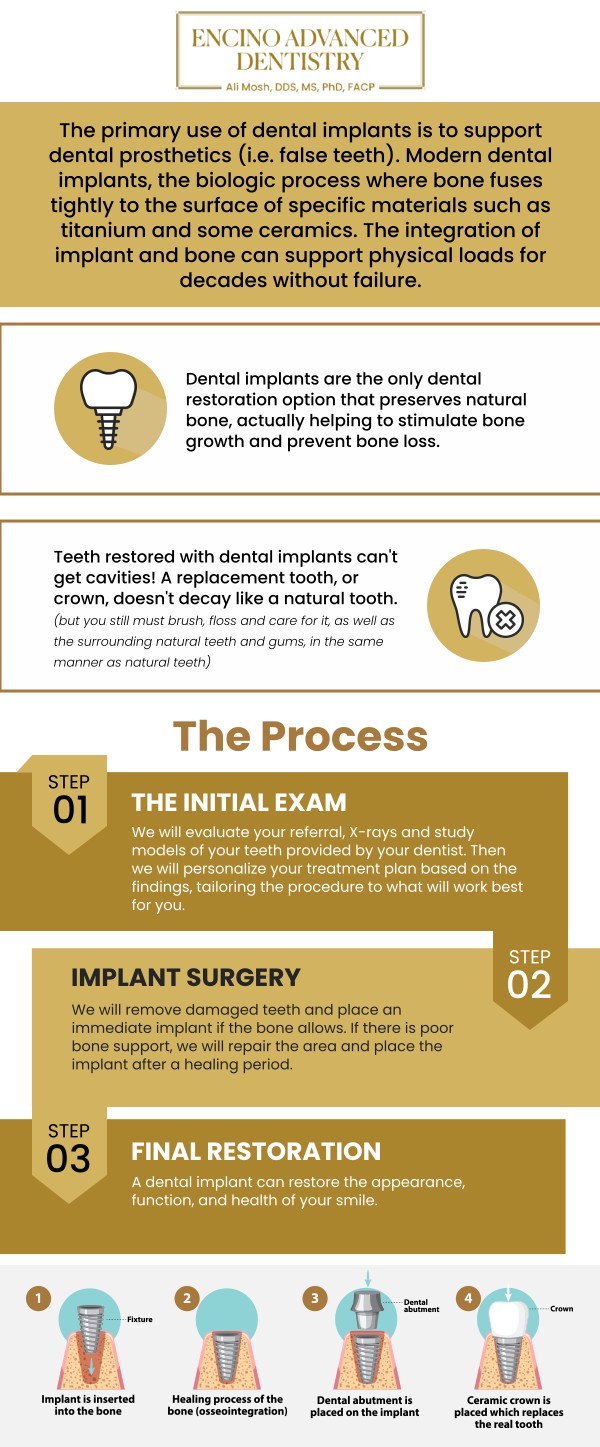 Dental implants are considered the most advanced and durable solution for replacing missing teeth, functioning and feeling remarkably like your natural teeth. These titanium fixtures are surgically placed into the jawbone, acting as sturdy artificial tooth roots that provide unparalleled stability for crowns, bridges, or dentures. Dr. Alireza Moshaverinia, D.D.S., M.S., Ph.D., F.A.C.P. at Encino Advanced Dentistry offers dental implants to restore full chewing ability, aesthetics, and prevent bone loss. For more information, contact us or request an appointment online. We are conveniently located at 5363 Balboa Blvd. #434 Encino, CA 91316.