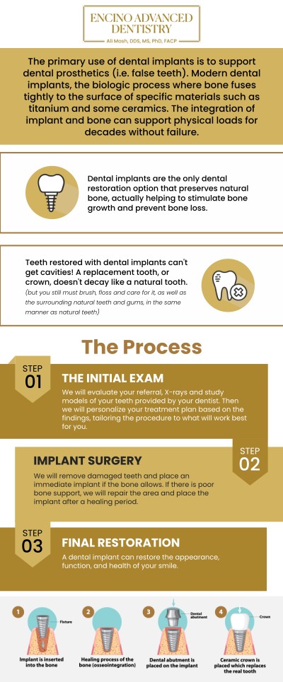 Dental implants are considered the most advanced and durable solution for replacing missing teeth, functioning and feeling remarkably like your natural teeth. These titanium fixtures are surgically placed into the jawbone, acting as sturdy artificial tooth roots that provide unparalleled stability for crowns, bridges, or dentures. Dr. Alireza Moshaverinia, D.D.S., M.S., Ph.D., F.A.C.P. at Encino Advanced Dentistry offers dental implants to restore full chewing ability, aesthetics, and prevent bone loss. For more information, contact us or request an appointment online. We are conveniently located at 5363 Balboa Blvd. #434 Encino, CA 91316.