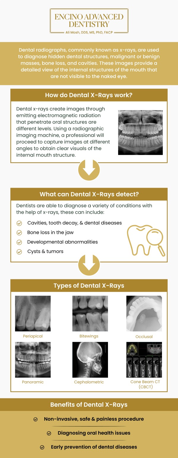 Common questions asked by patients: What is the difference between digital X-rays and traditional X-rays in dentistry? What are the benefits of using digital X-rays over traditional methods? How do digital X-rays improve the accuracy of dental diagnoses? How often are digital X-rays needed for routine dental checkups? For more information, contact us or schedule an appointment online. We are conveniently located at 5363 Balboa Blvd, #434 Encino, CA 91316. We serve patients from Encino CA, Tarzana CA, Van Nuys CA, Sherman Oaks CA, Calabasas CA, and surrounding areas.