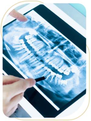 Digital X-Rays Near Me in Encino, CA