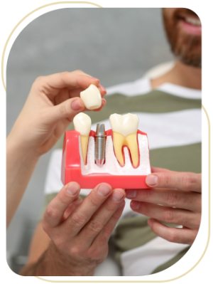 Implant-Supported Restorations Near Me in Encino, CA