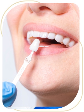 Lumineers Near Me in Encino, CA