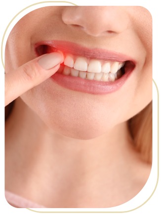 Non-surgical Periodontal Therapy Near Me in Encino, CA