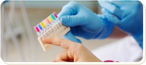 Why Choose Tooth-Colored Fillings Over Metal Fillings in Encino, CA?