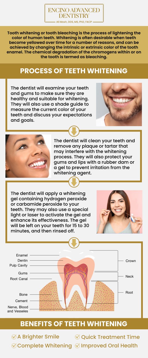 Common questions asked by patients: Can teeth whitening remove deep or intrinsic stains? What foods and drinks should be avoided after teeth whitening? Is teeth whitening suitable for crowns or veneers? How soon can I see results after professional teeth whitening? When should teeth whitening be avoided? For more information, contact us or schedule an appointment online. We are conveniently located at 5363 Balboa Blvd, #434 Encino, CA 91316. We serve patients from Encino CA, Tarzana CA, Van Nuys CA, Sherman Oaks CA, Calabasas CA, and surrounding areas.