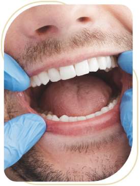 Cavities Treatment in Encino, CA