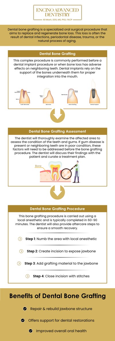A dental bone graft is a regenerative procedure essential for patients who have experienced bone loss in their jaw due to tooth extraction, gum disease, or trauma. The purpose of this technique is to rebuild sufficient bone volume and density, creating a strong, stable foundation necessary to support future dental implants or secure dentures properly. At Encino Advanced Dentistry, Dr. Alireza Moshaverinia, D.D.S., M.S., Ph.D., F.A.C.P., performs these grafting procedures with advanced precision, ensuring the optimal conditions for successful implant integration and the long-term structural integrity of your restored smile. For more information, contact us or request an appointment online. We are conveniently located at 5363 Balboa Blvd. #434 Encino, CA 91316.