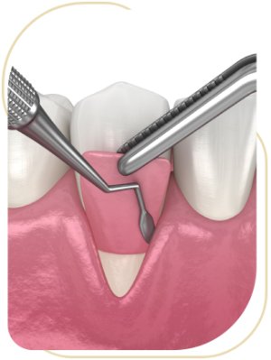 Gum & Jawbone Corrective Treatments Near Me in Encino, CA