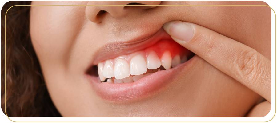 Gum Recession Treatment Specialist Near Me in Encino, CA
