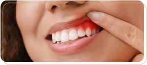 Gum Recession Treatment Specialist Near Me in Encino, CA