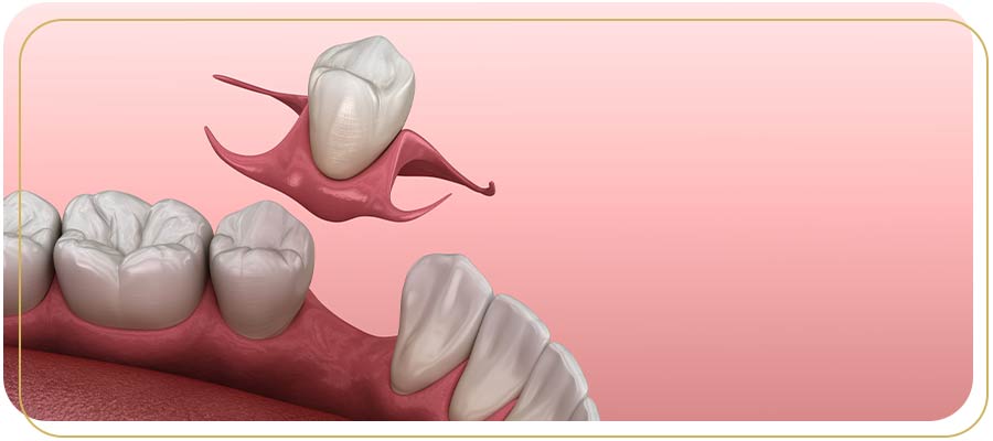 Ridge Preservation Treatment Specialist Near Me in Encino, CA