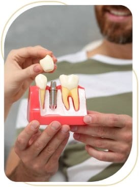 Dental Implants Near Me in Encino, CA