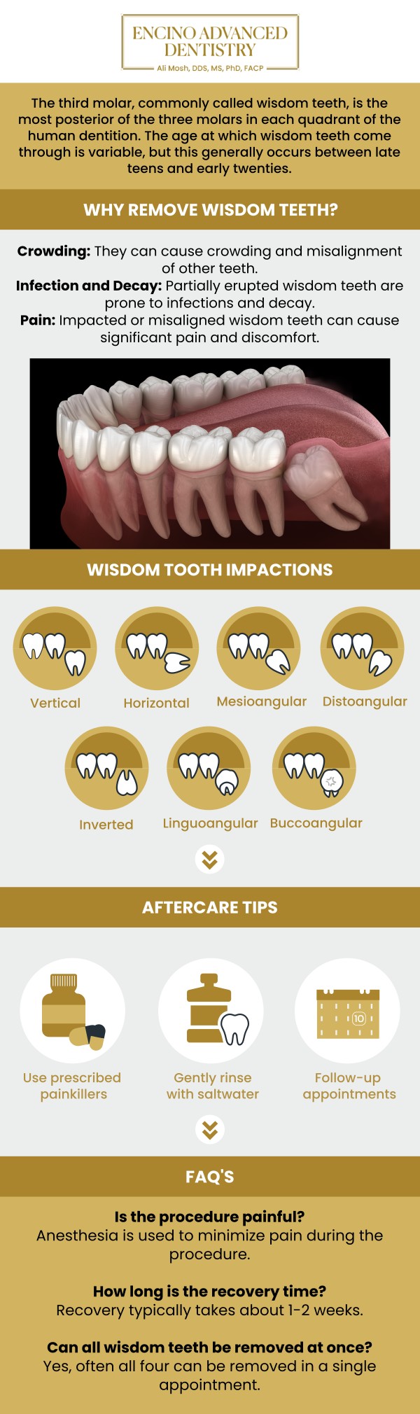 Common questions asked by patients: When should wisdom teeth be removed? What problems can impacted wisdom teeth cause? How is wisdom tooth removal performed? What should be done to prepare for wisdom tooth removal? Is wisdom tooth removal painful? For more information, contact us or schedule an appointment online. We are conveniently located at 5363 Balboa Blvd, #434 Encino, CA 91316. We serve patients from Encino CA, Tarzana CA, Van Nuys CA, Sherman Oaks CA, Calabasas CA, and surrounding areas.