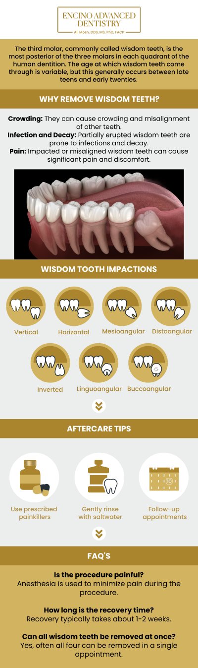 Common questions asked by patients: When should wisdom teeth be removed? What problems can impacted wisdom teeth cause? How is wisdom tooth removal performed? What should be done to prepare for wisdom tooth removal? Is wisdom tooth removal painful? For more information, contact us or schedule an appointment online. We are conveniently located at 5363 Balboa Blvd, #434 Encino, CA 91316. We serve patients from Encino CA, Tarzana CA, Van Nuys CA, Sherman Oaks CA, Calabasas CA, and surrounding areas.