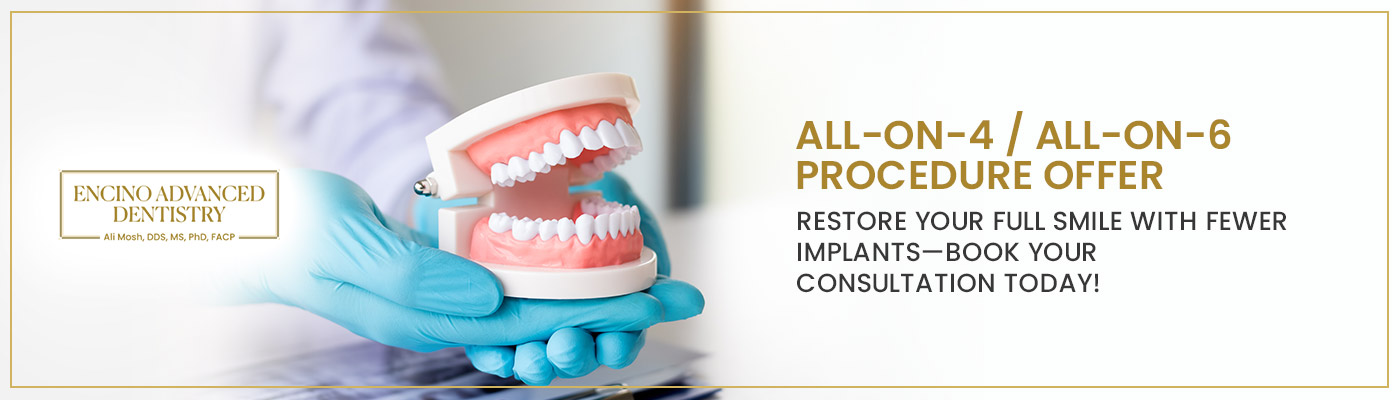All-on-4 / All-on-6 Procedure Offer
Restore your full smile with fewer implants—book your consultation today in Encino, CA?
