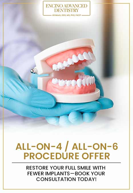 All-on-4 / All-on-6 Procedure Offer
Restore your full smile with fewer implants—book your consultation today in Encino, CA?
