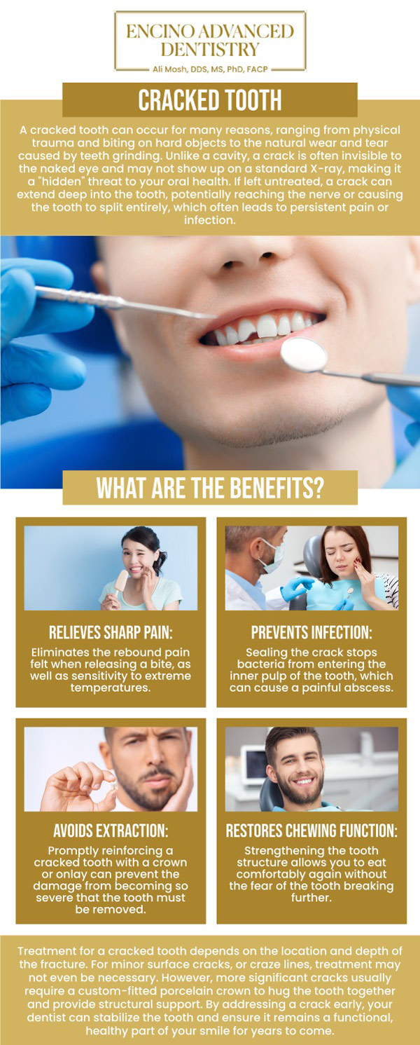 Cracked teeth can be caused by biting on hard foods, teeth grinding, trauma, large fillings, or natural wear over time. Treatment depends on the severity of the crack and may include bonding, crowns, or other restorative options to protect the tooth. Early evaluation is important to prevent pain, infection, or further damage. For accurate diagnosis and personalized treatment, visit Dr. Alireza Moshaverinia, D.D.S., M.S., Ph.D., F.A.C.P., for comprehensive cracked tooth care. For more information, contact us or request an appointment online. We are conveniently located at 5363 Balboa Blvd, #434 Encino, CA 91316.