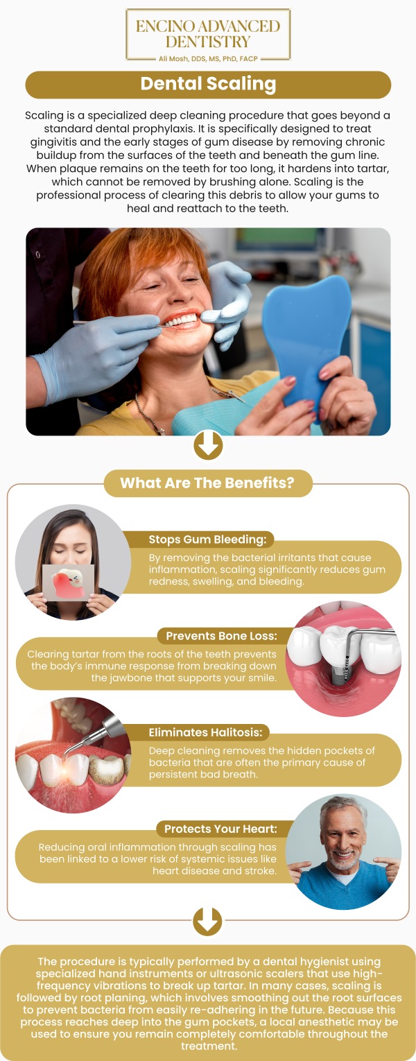 Common questions asked by patients: What is the process of dental scaling? How does dental scaling help prevent gum disease? Is dental scaling covered by dental insurance? How long does a dental scaling procedure take? For more information, contact us or schedule an appointment online. We are conveniently located at 5363 Balboa Blvd, #434 Encino, CA 91316. We serve patients from Encino CA, Tarzana CA, Van Nuys CA, Sherman Oaks CA, Calabasas CA, and surrounding areas.
