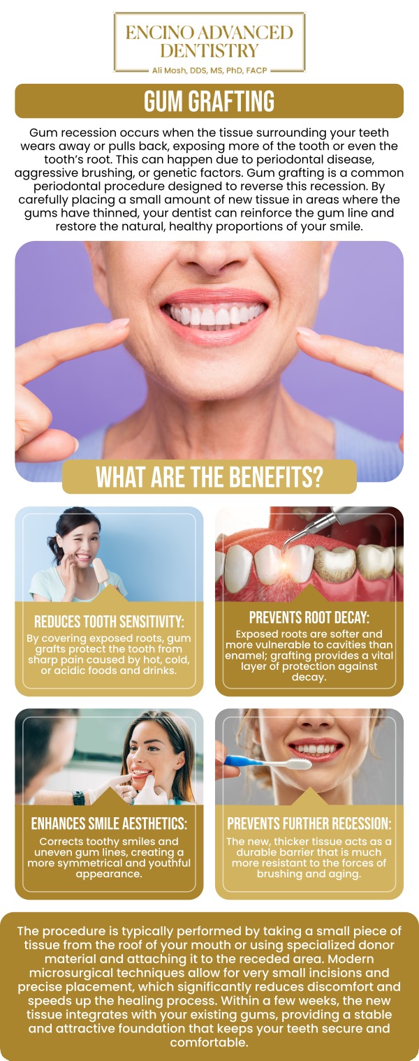 Common questions asked by patients: What is gum grafting, and why is it needed? How does gum grafting help with gum recession? Can gum grafting be used to treat gum disease or just gum recession? How long do gum grafts last, and do they require maintenance? For more information, contact us or schedule an appointment online. We are conveniently located at 5363 Balboa Blvd, #434 Encino, CA 91316. We serve patients from Encino CA, Tarzana CA, Van Nuys CA, Sherman Oaks CA, Calabasas CA, and surrounding areas. Common questions asked by patients: What is gum grafting, and why is it needed? How does gum grafting help with gum recession? Can gum grafting be used to treat gum disease or just gum recession? How long do gum grafts last, and do they require maintenance? For more information, contact us or schedule an appointment online. We are conveniently located at 5363 Balboa Blvd, #434 Encino, CA 91316. We serve patients from Encino CA, Tarzana CA, Van Nuys CA, Sherman Oaks CA, Calabasas CA, and surrounding areas.