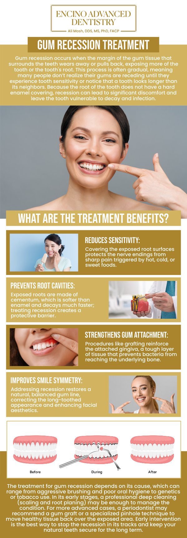 Common questions asked by patients: What is gum recession, and how does it affect your oral health? What are the causes of gum recession? How does gum recession treatment prevent tooth sensitivity and bone loss? Is gum recession treatment painful, and what is the recovery like? How long does it take to see results after gum recession treatment? For more information, contact us or schedule an appointment online. We are conveniently located at 5363 Balboa Blvd, #434 Encino, CA 91316. We serve patients from Encino CA, Tarzana CA, Van Nuys CA, Sherman Oaks CA, Calabasas CA, and surrounding areas. Common questions asked by patients: What is gum recession, and how does it affect your oral health? What are the causes of gum recession? How does gum recession treatment prevent tooth sensitivity and bone loss? Is gum recession treatment painful, and what is the recovery like? How long does it take to see results after gum recession treatment? For more information, contact us or schedule an appointment online. We are conveniently located at 5363 Balboa Blvd, #434 Encino, CA 91316. We serve patients from Encino CA, Tarzana CA, Van Nuys CA, Sherman Oaks CA, Calabasas CA, and surrounding areas.