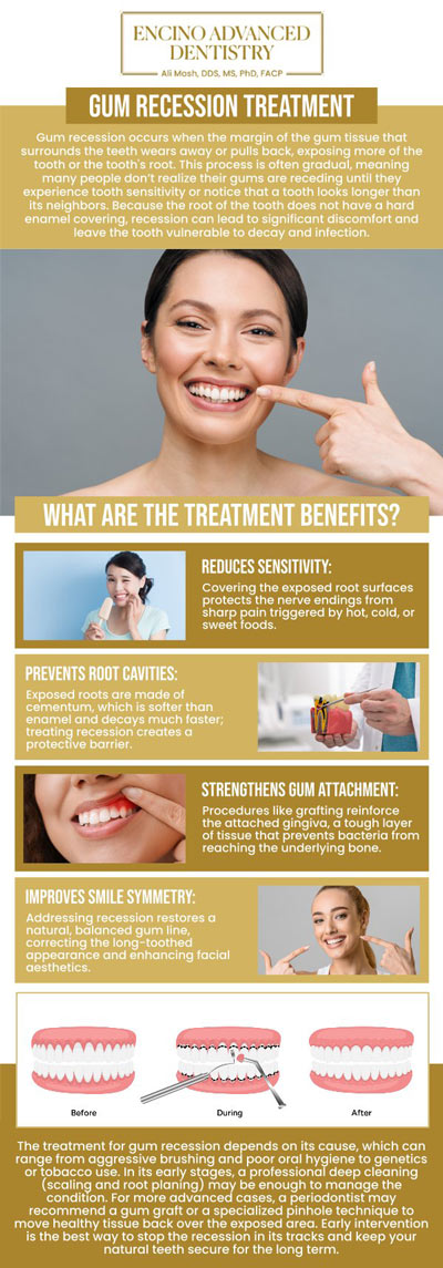 Common questions asked by patients: What is gum recession, and how does it affect your oral health? What are the causes of gum recession? How does gum recession treatment prevent tooth sensitivity and bone loss? Is gum recession treatment painful, and what is the recovery like? How long does it take to see results after gum recession treatment? For more information, contact us or schedule an appointment online. We are conveniently located at 5363 Balboa Blvd, #434 Encino, CA 91316. We serve patients from Encino CA, Tarzana CA, Van Nuys CA, Sherman Oaks CA, Calabasas CA, and surrounding areas. Common questions asked by patients: What is gum recession, and how does it affect your oral health? What are the causes of gum recession? How does gum recession treatment prevent tooth sensitivity and bone loss? Is gum recession treatment painful, and what is the recovery like? How long does it take to see results after gum recession treatment? For more information, contact us or schedule an appointment online. We are conveniently located at 5363 Balboa Blvd, #434 Encino, CA 91316. We serve patients from Encino CA, Tarzana CA, Van Nuys CA, Sherman Oaks CA, Calabasas CA, and surrounding areas.