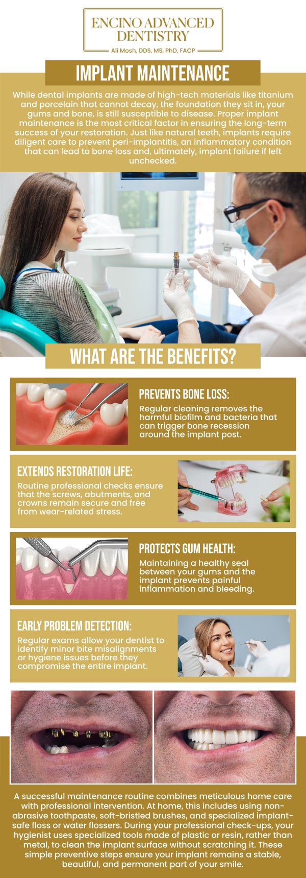 While dental implants are engineered to be a lifelong solution for tooth loss, they are not "set it and forget it" devices. At Encino Advanced Dentistry, Dr. Alireza Moshaverinia, DDS, MS, Ph D, FACP, emphasizes that the longevity of your restoration depends entirely on the health of the supporting bone and gum tissue. Specialized implant maintenance is the proactive process of cleaning and monitoring these components to ensure your investment remains functional, beautiful, and free from biological complications. For more information, contact us or request an appointment online. We are conveniently located at 5363 Balboa Blvd, #434 Encino, CA 91316.