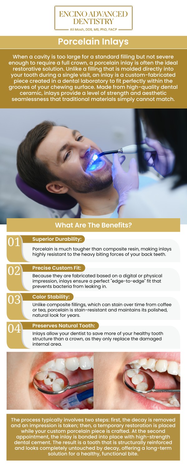 Experience the perfect blend of strength and aesthetics with porcelain inlays, a premier restorative solution designed to repair teeth with mild to moderate decay or damage. Unlike standard fillings, these custom-crafted restorations are fabricated in a lab to fit precisely within the grooves of your tooth, effectively preserving more of your natural tooth structure. The result is a durable, stain-resistant finish that mimics the translucency of natural enamel, restoring both the function and beauty of your smile. Consult Dr. Alireza Moshaverinia, D.D.S., M.S., Ph.D., F.A.C.P. at Encino Advanced Dentistry. For more information, contact us or request an appointment online. We are conveniently located at 5363 Balboa Blvd, #434 Encino, CA 91316.