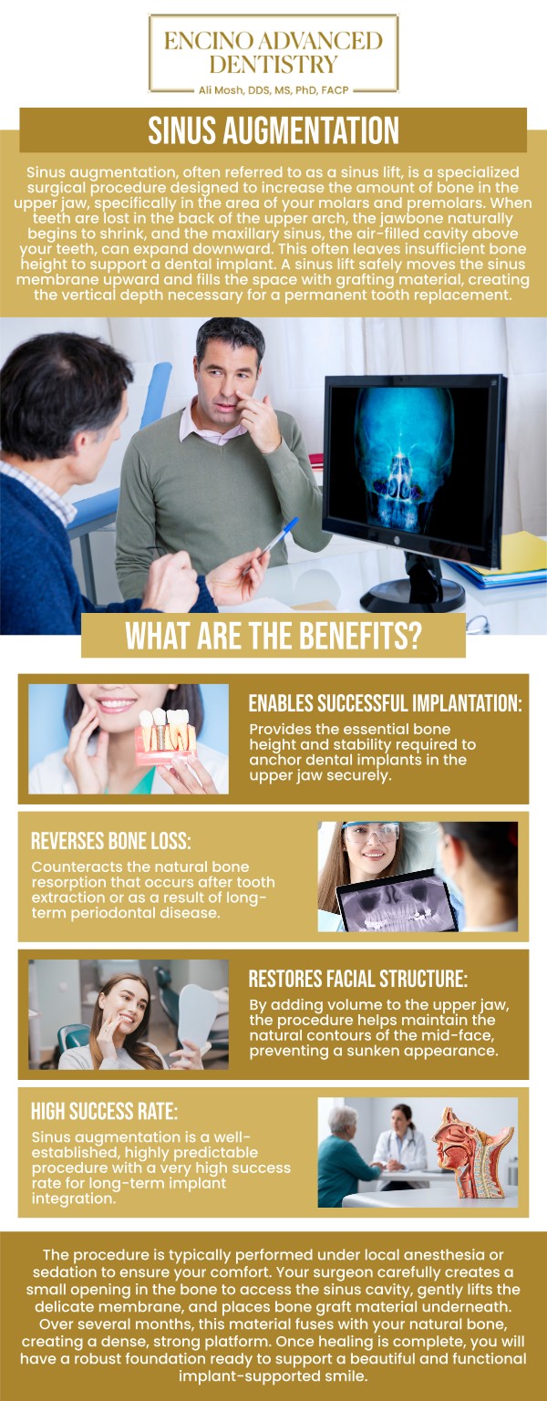 Common questions asked by patients: What is sinus augmentation treatment, and why is it needed for dental implants? How does sinus augmentation help prepare the jaw for implant placement? Who is a good candidate for sinus augmentation treatment? What happens during a sinus augmentation procedure? How long does it take to heal after sinus augmentation treatment? For more information, contact us or schedule an appointment online. We are conveniently located at 5363 Balboa Blvd, #434 Encino, CA 91316. We serve patients from Encino CA, Tarzana CA, Van Nuys CA, Sherman Oaks CA, Calabasas CA, and surrounding areas. Common questions asked by patients: What is sinus augmentation treatment, and why is it needed for dental implants? How does sinus augmentation help prepare the jaw for implant placement? Who is a good candidate for sinus augmentation treatment? What happens during a sinus augmentation procedure? How long does it take to heal after sinus augmentation treatment? For more information, contact us or schedule an appointment online. We are conveniently located at 5363 Balboa Blvd, #434 Encino, CA 91316. We serve patients from Encino CA, Tarzana CA, Van Nuys CA, Sherman Oaks CA, Calabasas CA, and surrounding areas.