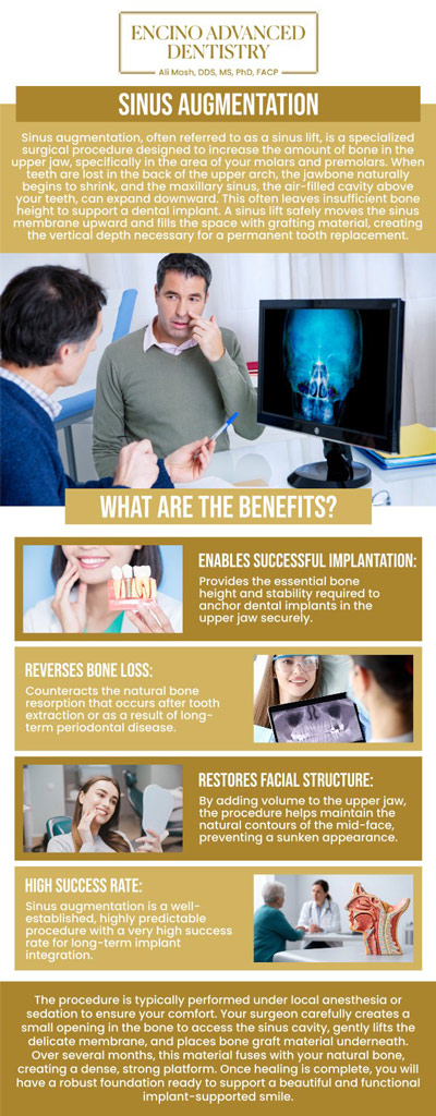 Common questions asked by patients: What is sinus augmentation treatment, and why is it needed for dental implants? How does sinus augmentation help prepare the jaw for implant placement? Who is a good candidate for sinus augmentation treatment? What happens during a sinus augmentation procedure? How long does it take to heal after sinus augmentation treatment? For more information, contact us or schedule an appointment online. We are conveniently located at 5363 Balboa Blvd, #434 Encino, CA 91316. We serve patients from Encino CA, Tarzana CA, Van Nuys CA, Sherman Oaks CA, Calabasas CA, and surrounding areas. Common questions asked by patients: What is sinus augmentation treatment, and why is it needed for dental implants? How does sinus augmentation help prepare the jaw for implant placement? Who is a good candidate for sinus augmentation treatment? What happens during a sinus augmentation procedure? How long does it take to heal after sinus augmentation treatment? For more information, contact us or schedule an appointment online. We are conveniently located at 5363 Balboa Blvd, #434 Encino, CA 91316. We serve patients from Encino CA, Tarzana CA, Van Nuys CA, Sherman Oaks CA, Calabasas CA, and surrounding areas.