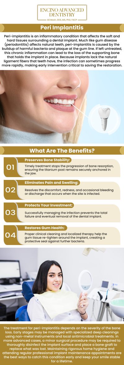Common questions asked by patients: What is peri-implantitis, and how does it affect dental implants? How can peri-implantitis be prevented before it develops? What are the signs and symptoms of peri-implantitis? How can peri-implantitis treatment improve the longevity of my dental implants? For more information, contact us or schedule an appointment online. We are conveniently located at 5363 Balboa Blvd, #434 Encino, CA 91316. We serve patients from Encino CA, Tarzana CA, Van Nuys CA, Sherman Oaks CA, Calabasas CA, and surrounding areas.