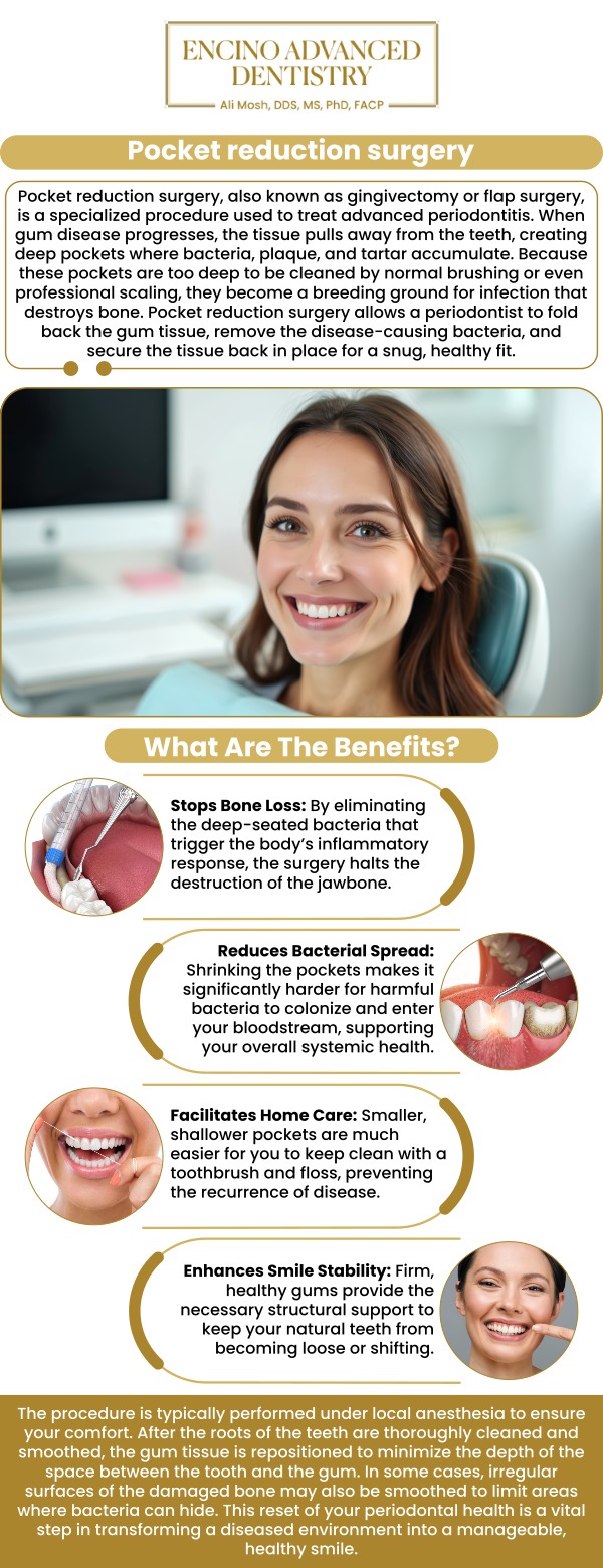 Common questions asked by patients: How does pocket reduction surgery improve gum health and prevent tooth loss? When is pocket reduction surgery recommended for patients with periodontal disease? What can you expect during and after pocket reduction surgery? How long is the recovery process for pocket reduction surgery? For more information, contact us or schedule an appointment online. We are conveniently located at 5363 Balboa Blvd, #434 Encino, CA 91316. We serve patients from Encino CA, Tarzana CA, Van Nuys CA, Sherman Oaks CA, Calabasas CA, and surrounding areas.