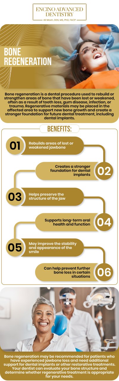 Common questions asked by patients: What is bone regeneration treatment and how does it work? When is bone regeneration treatment necessary for dental or medical procedures? How long does it take to see results from bone regeneration treatments? Is bone regeneration treatment painful, and how is pain managed? What is the recovery time after a bone regeneration procedure? For more information, contact us or schedule an appointment online. We are conveniently located at 5363 Balboa Blvd, #434 Encino, CA 91316. We serve patients from Encino CA, Tarzana CA, Van Nuys CA, Sherman Oaks CA, Calabasas CA, and surrounding cities.